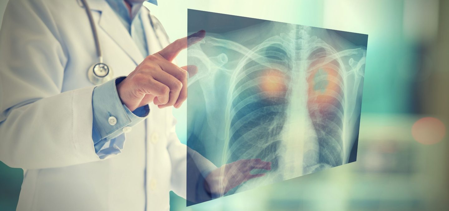 Lunit and Samsung Electronics forge a three-year pact to revolutionize chest X-ray screening